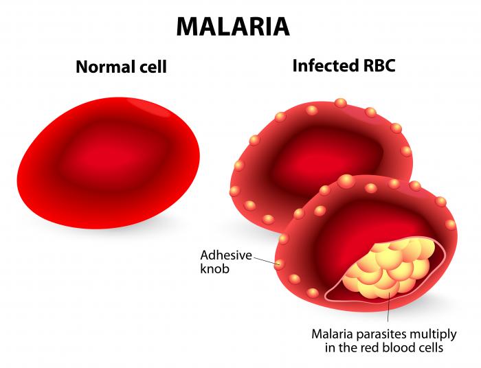 Under-reporting of Malaria cases still a challenge- Dr Quacy Grant