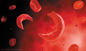 sickled-red-blood-cells-anemia-disease