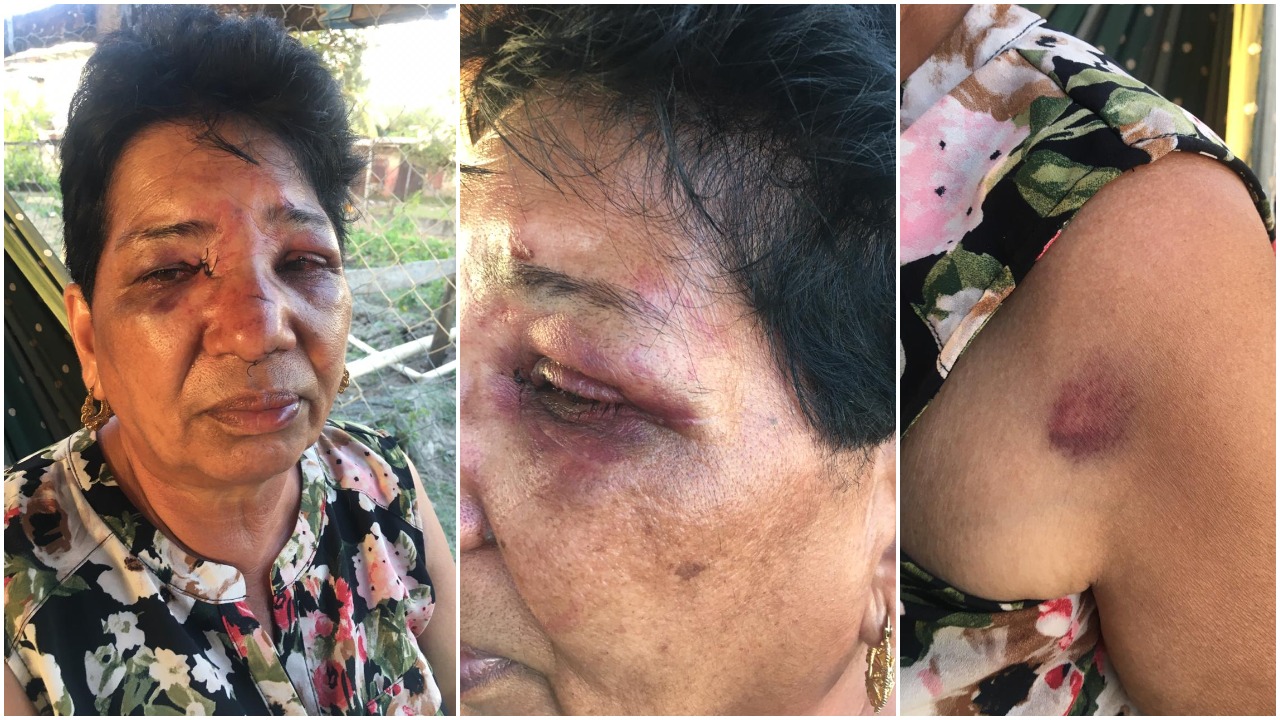 Bandits beat, choke elderly Berbice woman, hold husband at gunpoint during robbery